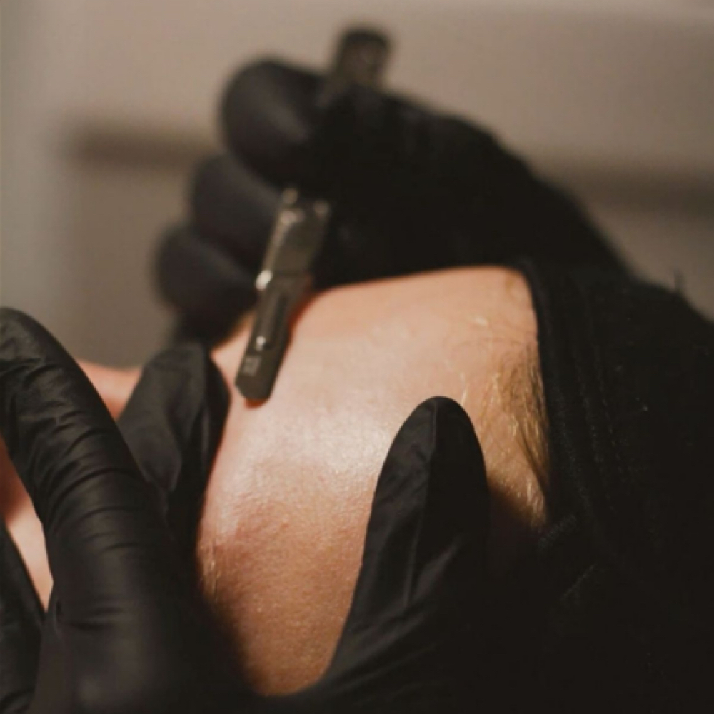 Dermaplane Facial at Esthetics by Kaiya in Bedford, NH