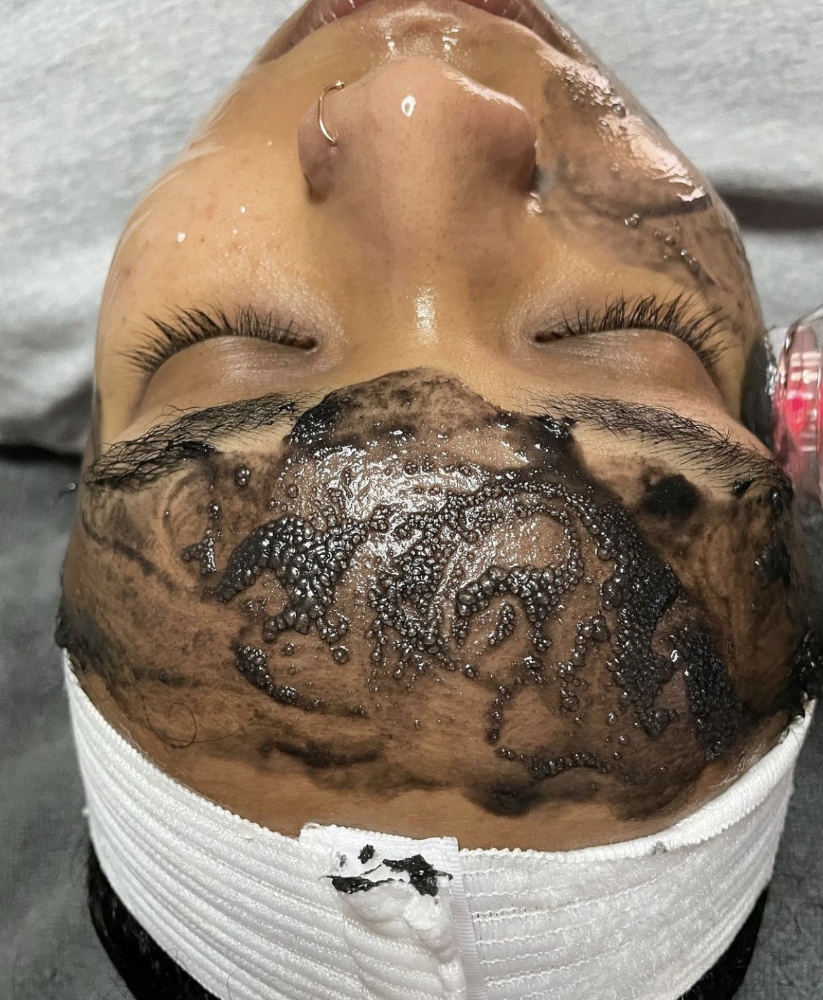 Oxygeneo Facial + Add on