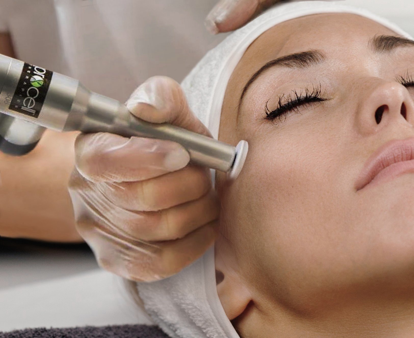 Microchanneling MD-Face at Rae & Co Esthetics Studio in Pensacola, FL