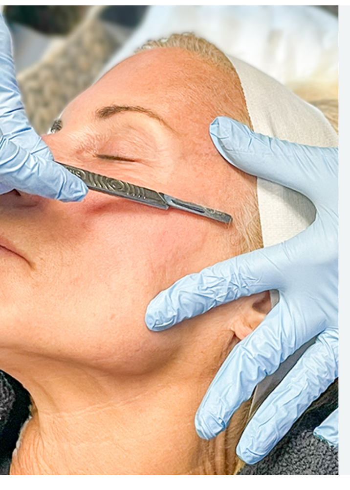 Dermaplane Add On
