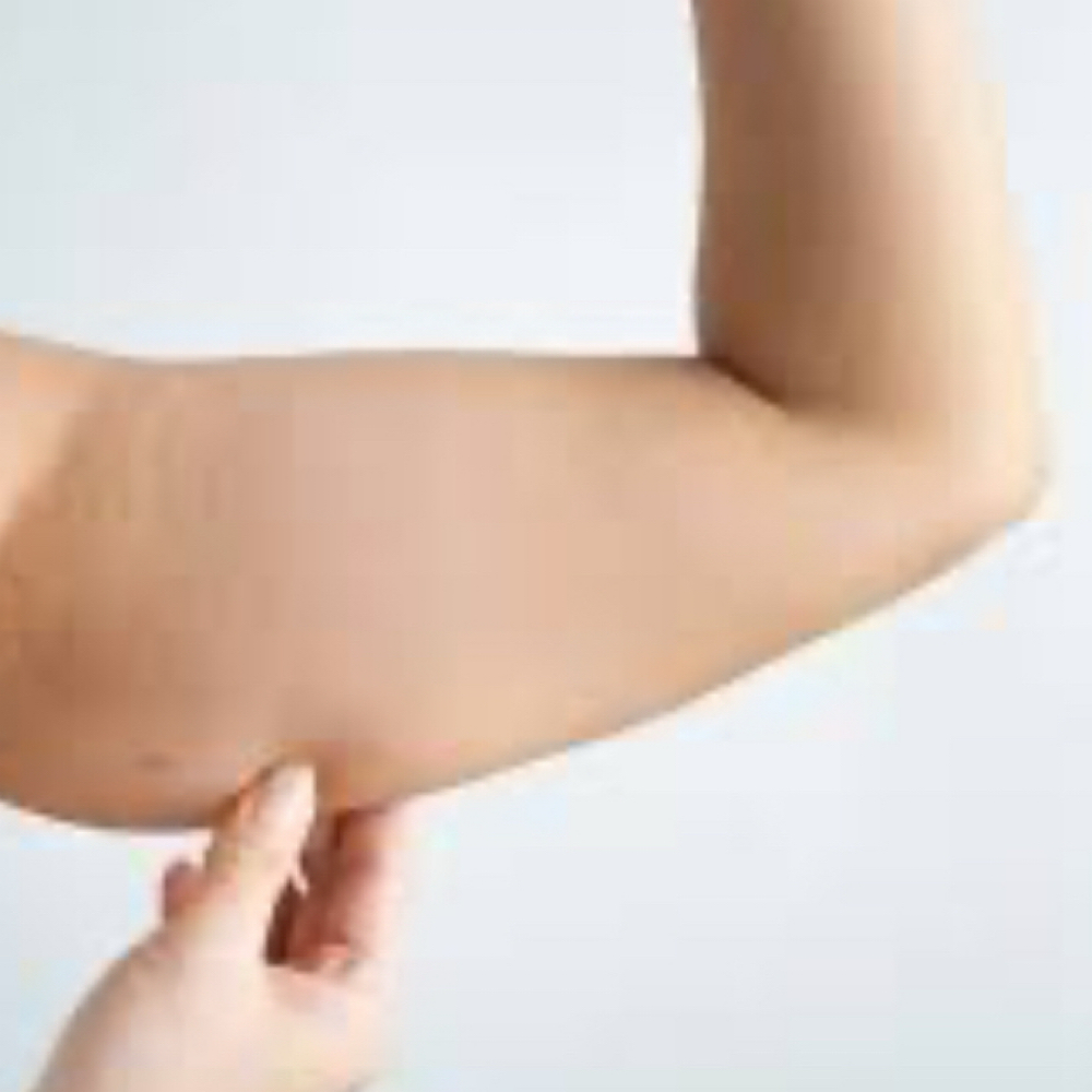 6 Arms Sculpt (flanby Arms ) at Aesthetics By Aline in Danvers, MA