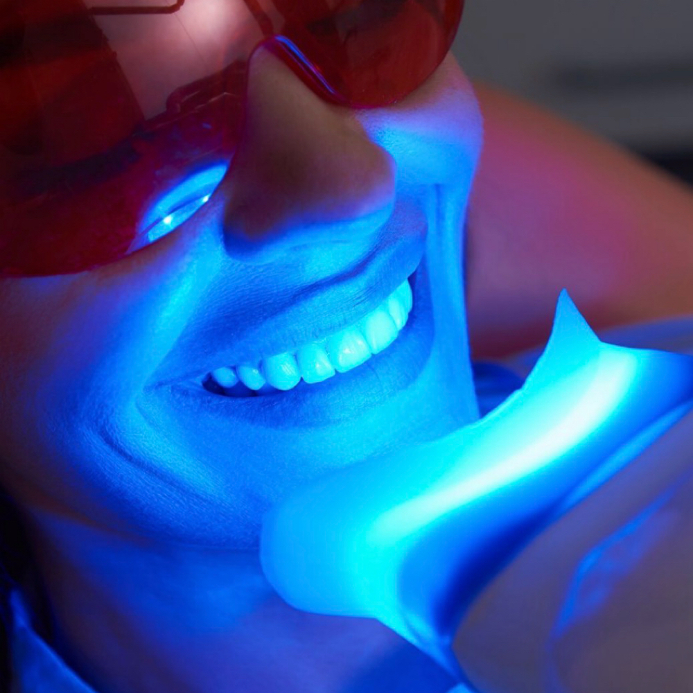 Teeth Whitening at Jaycie.The.Esti in Abilene, TX