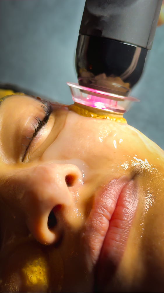 Glo2Facial Packages