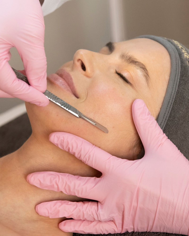 Dermaplaning Facial