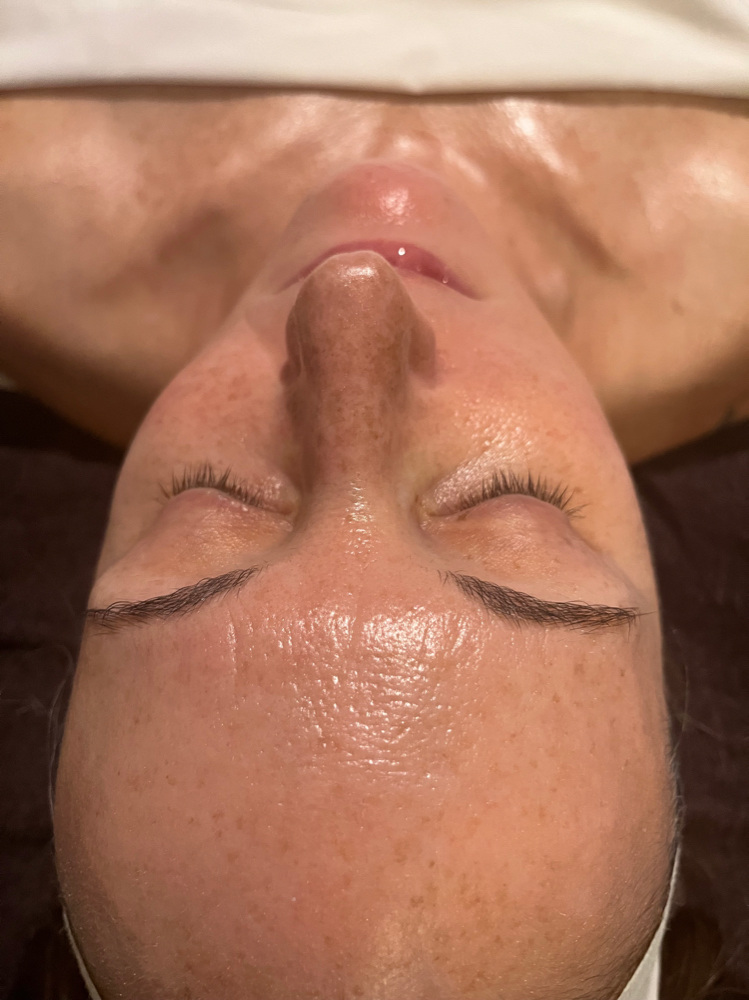 Its Been Awhile Facial(Vit C Peel)