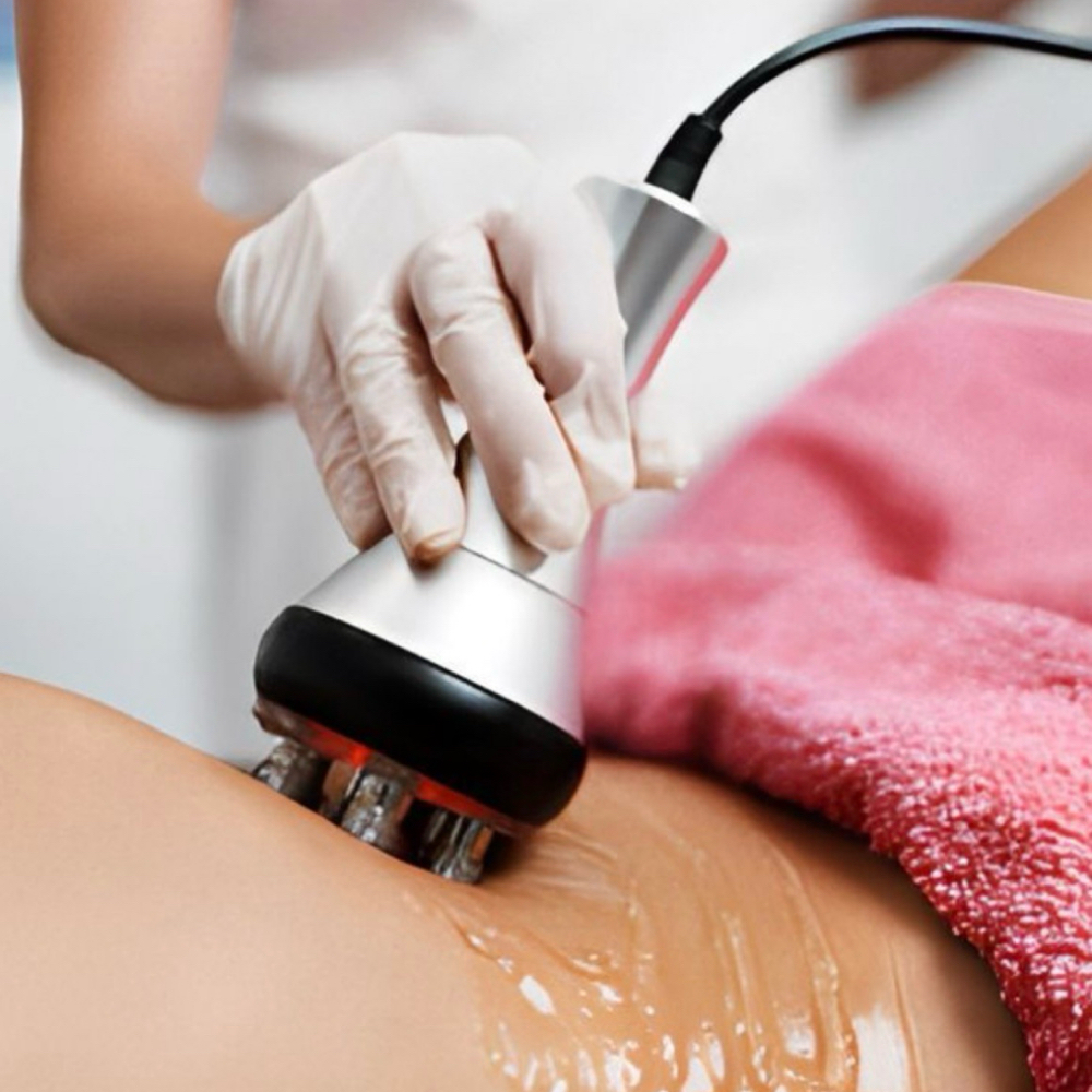 Body Sculpting – 4 Session Package at Prism Beauty in San Juan Capistrano, CA