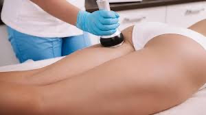 Cellulite Treatment