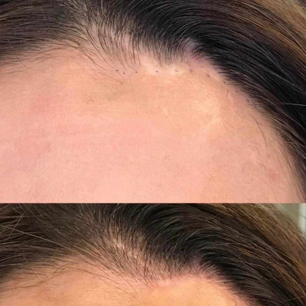 Scar Camouflage at Fluff & Ink in Tustin, CA