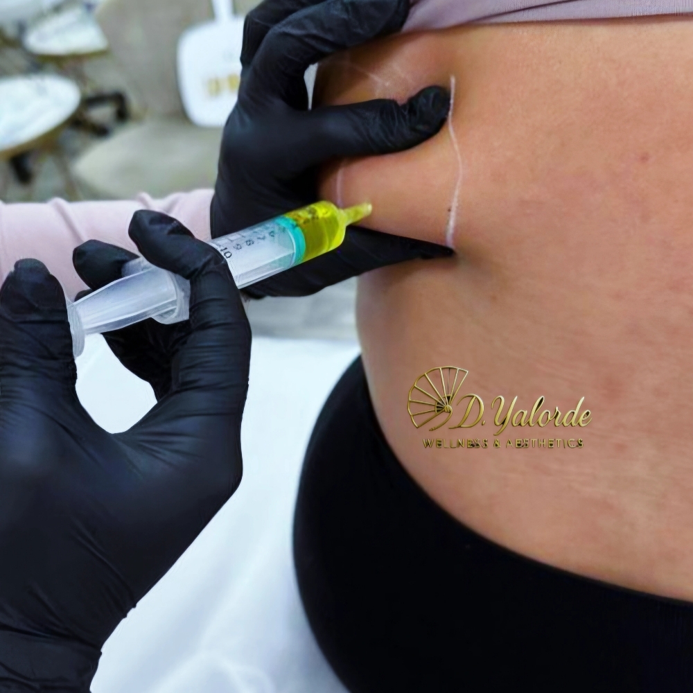 LipoShots at D'Yalorde Wellness & Aesthetics LLC in El Paso, TX