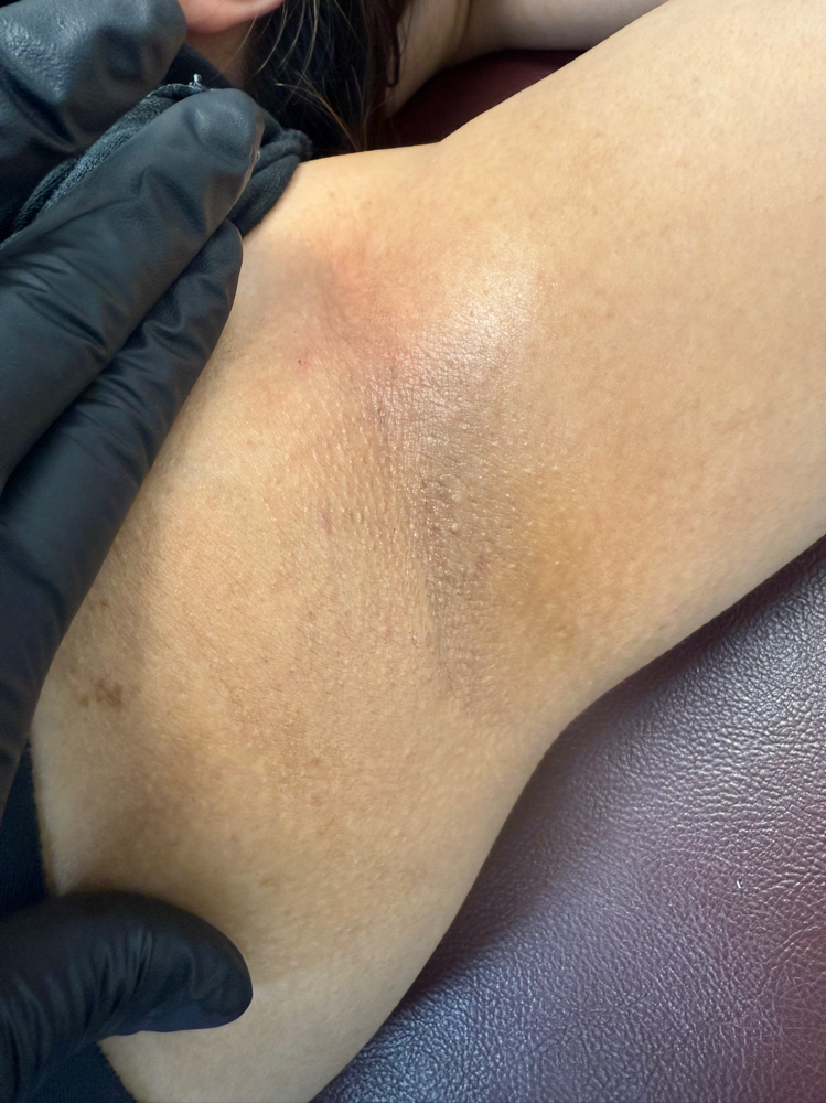 Underarm Wax