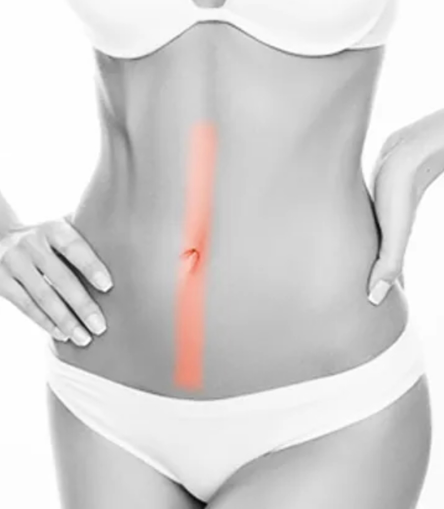 Tummy Trail Wax