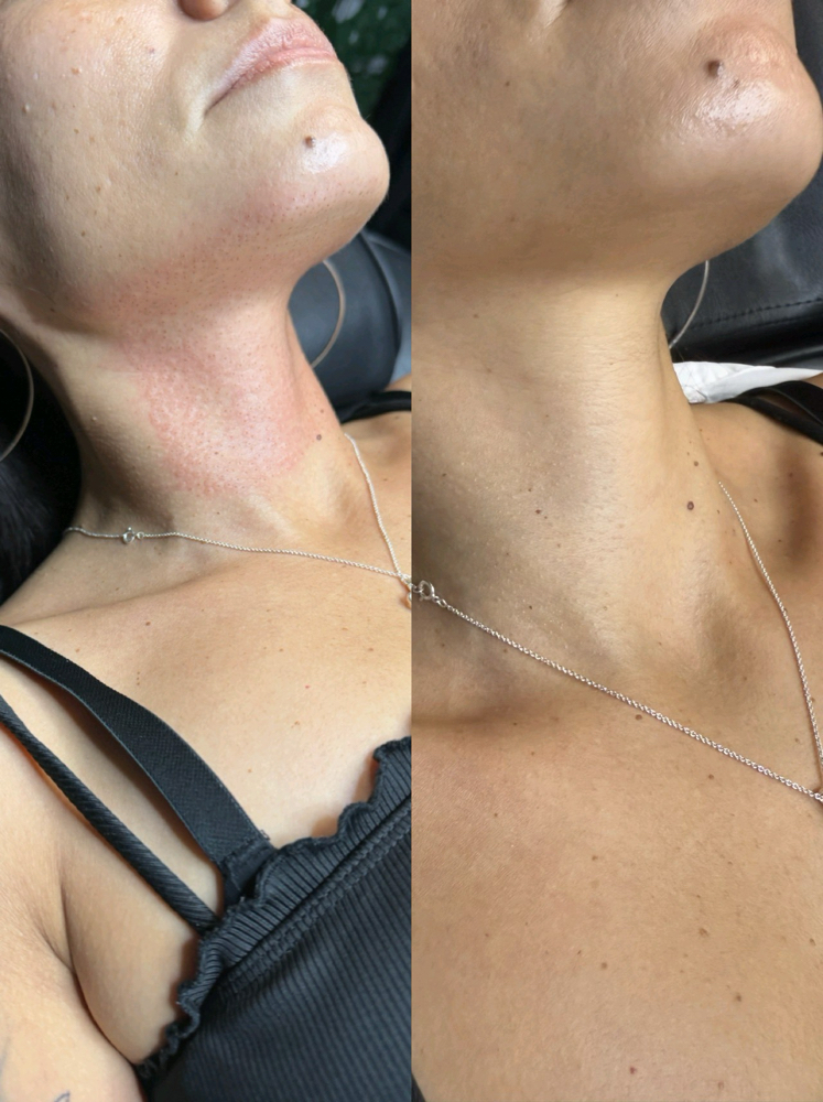 Full Neck