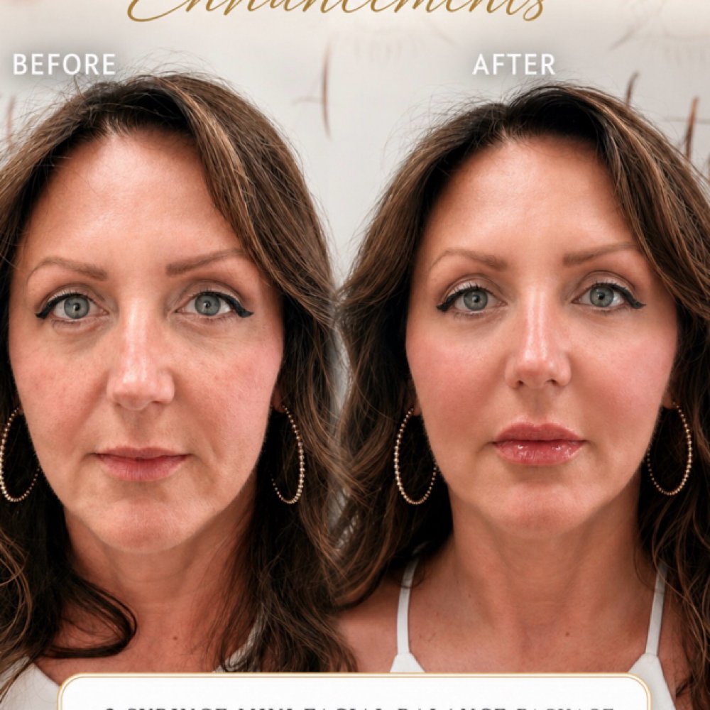 ✨4 Areas + Botox Facial Balancing at Savage Artistry in melbourne, FL