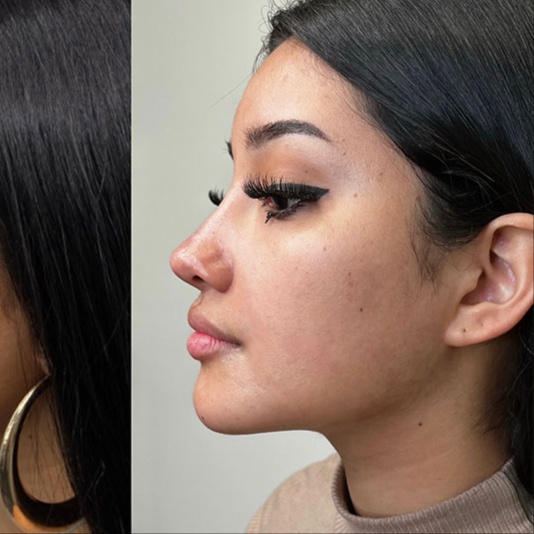 ✨ Tier 2 Balance 4ml at Savage Artistry in melbourne, FL