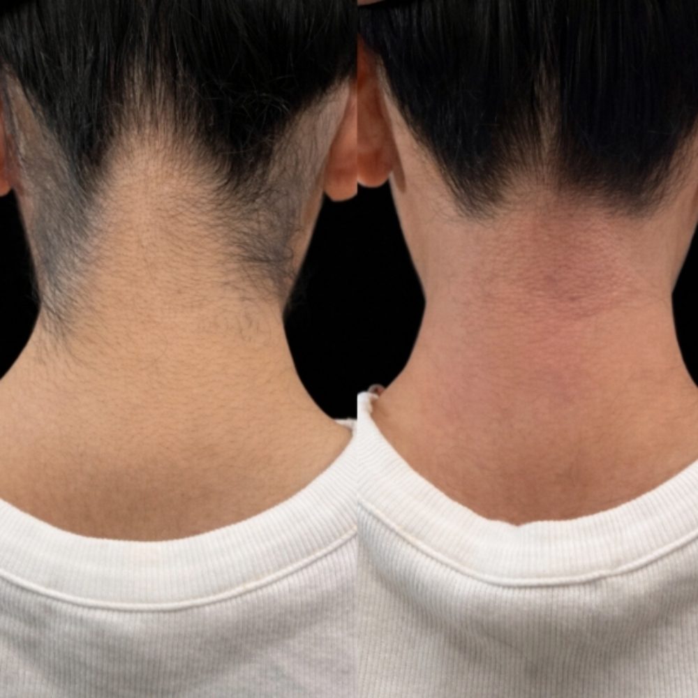 NECK WAX at EYE CANDY ENVY RENO in RENO, NV