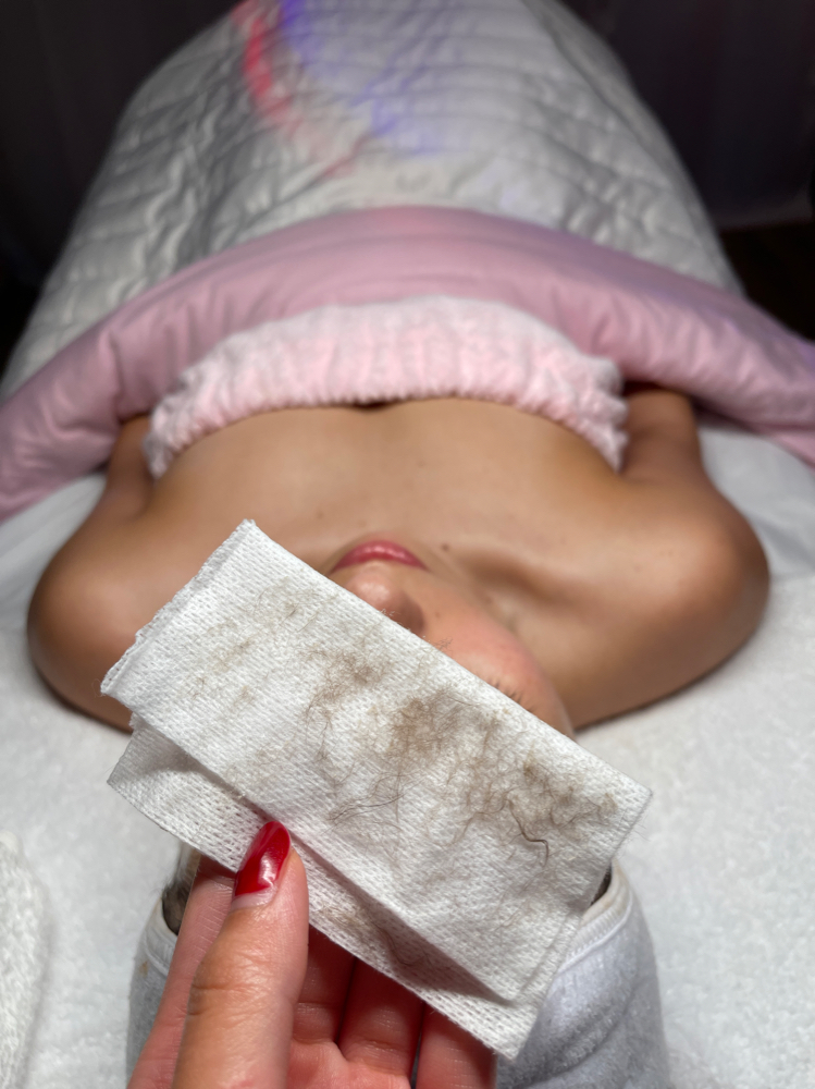 DERMAPLANE FACIAL
