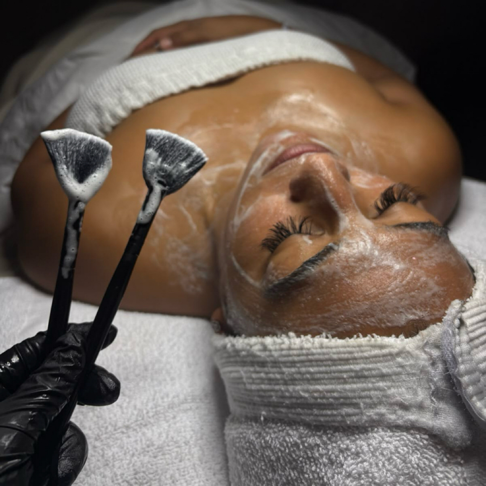 Acne Facial at Silk + Skin Aesthetics in Tallassee, AL