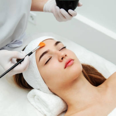 Student Acne Special at Victoria Still Esthetics in Carthage, MO