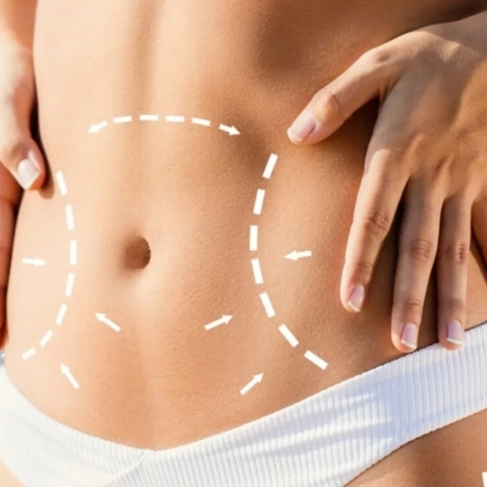 Body Contouring Session at Tranquil Escape Wellness Spa in Granbury, TX
