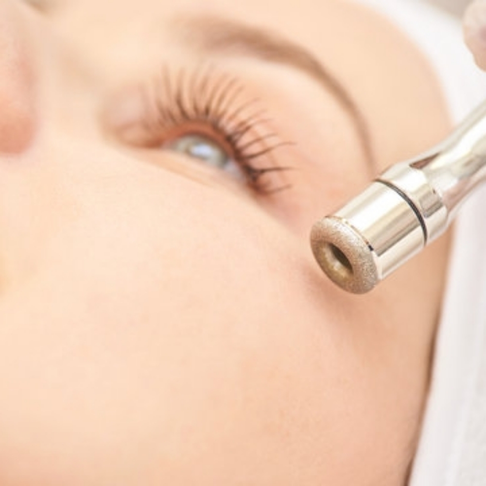 Diamond Microdermabrasion at Anchors Aweigh Spa in Spring, TX