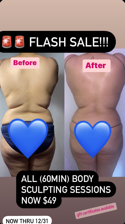 Body Sculpting