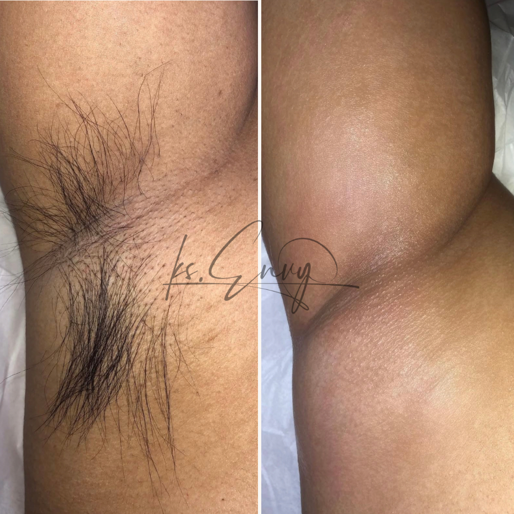 Underarms at KS.Envy in Columbus, OH