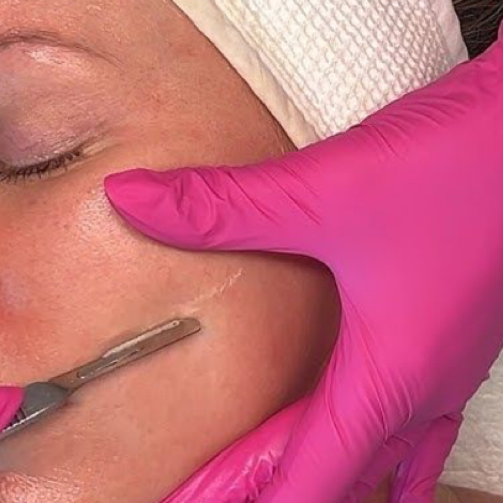 Express Dermaplane Treatment at Pure Beauty by Kenzie Grace in Cynthiana, KY