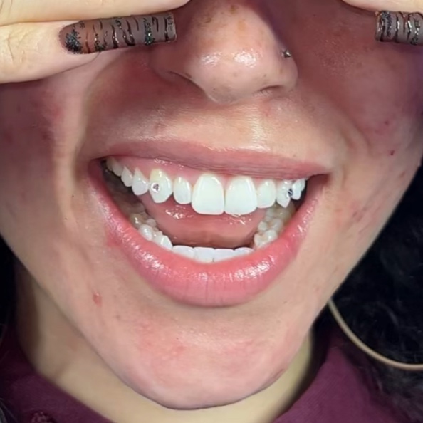 Tooth Gem (1) at Haus of Femme in Brooklyn, NY