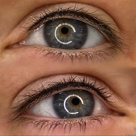 Lash Lining Enhancement