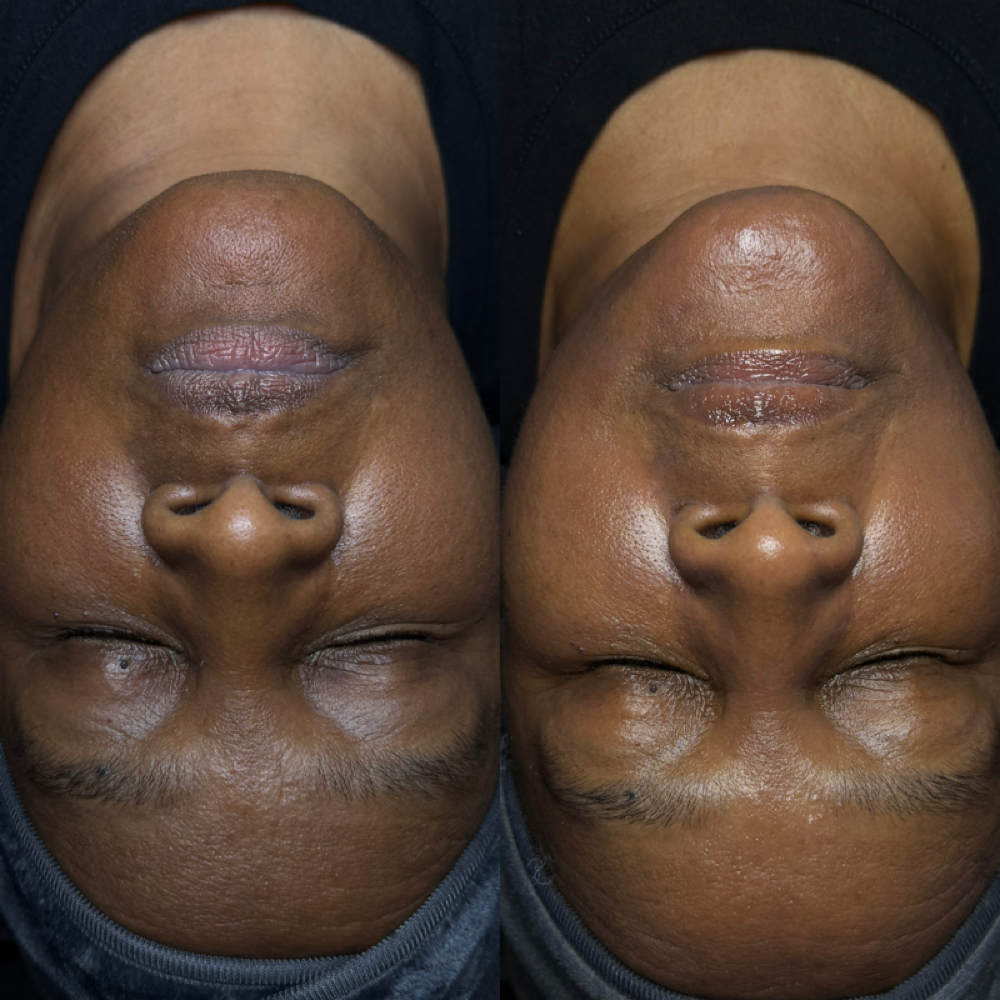 Tier II | The Luxe Glow Facial at Beauty Vault Studios in Hamden, CT