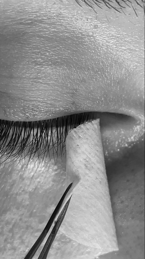 Lash Removal