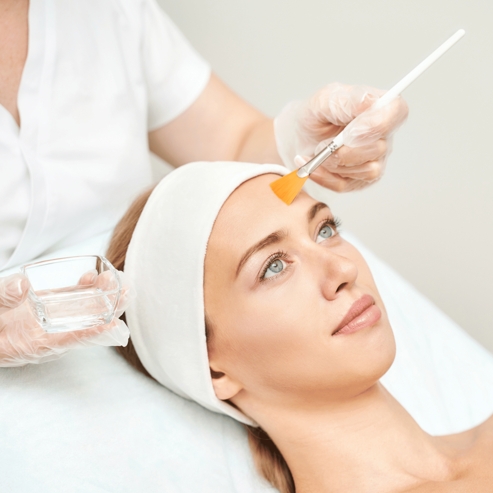 Chemical Peel  For Acne& Melasma