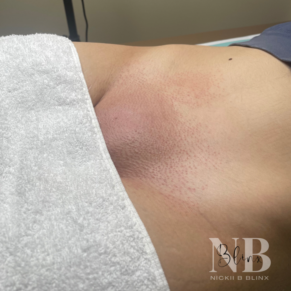 Bikini Waxing
