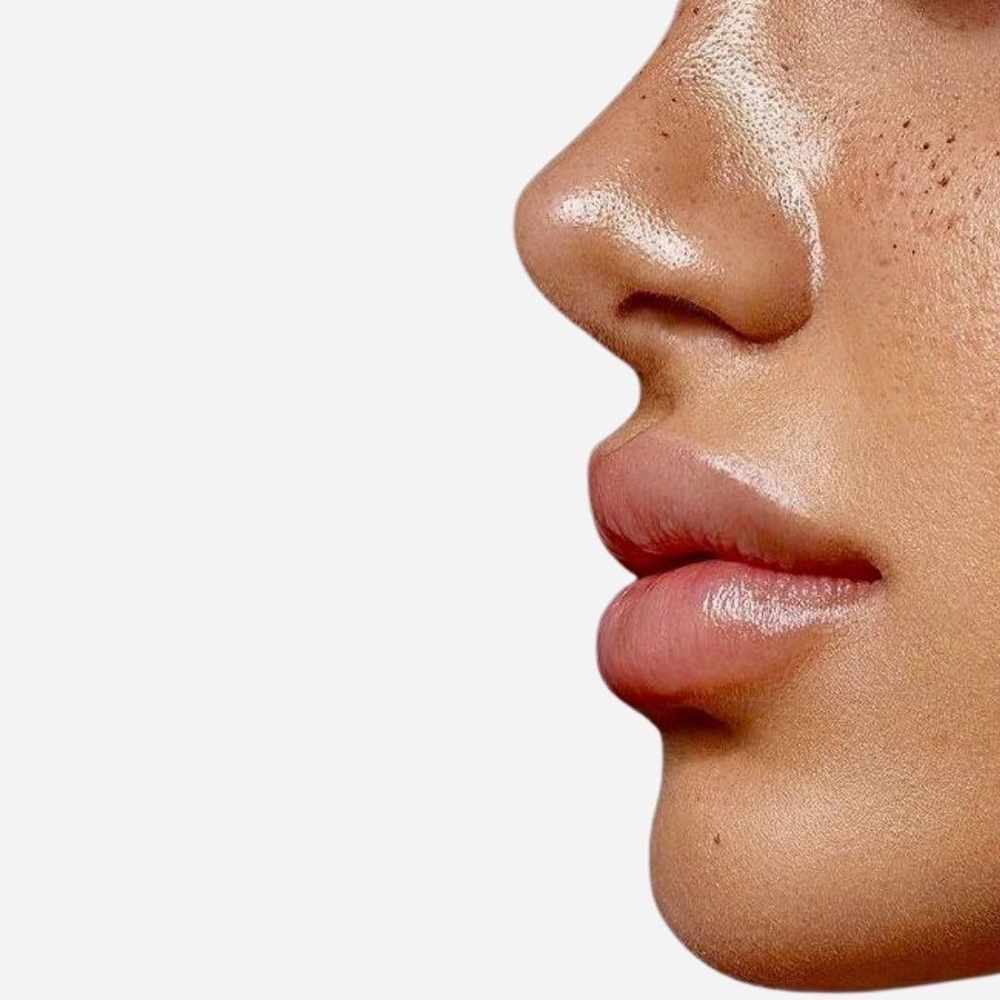 3 Microneedle Face, Neck, Decolette at Magnolia Artistry in Draper, UT