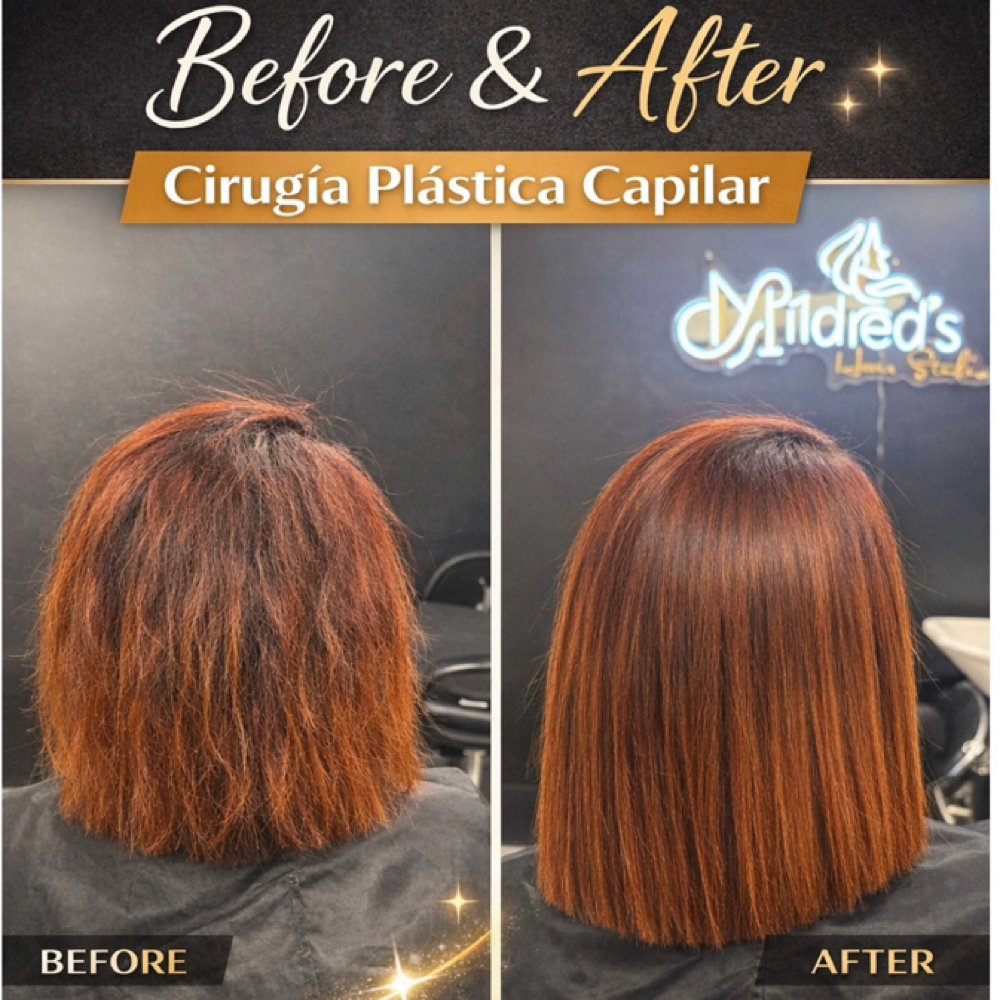 Plastic surgury Treatment at Mildred’s Hair Studio in Concord, CA