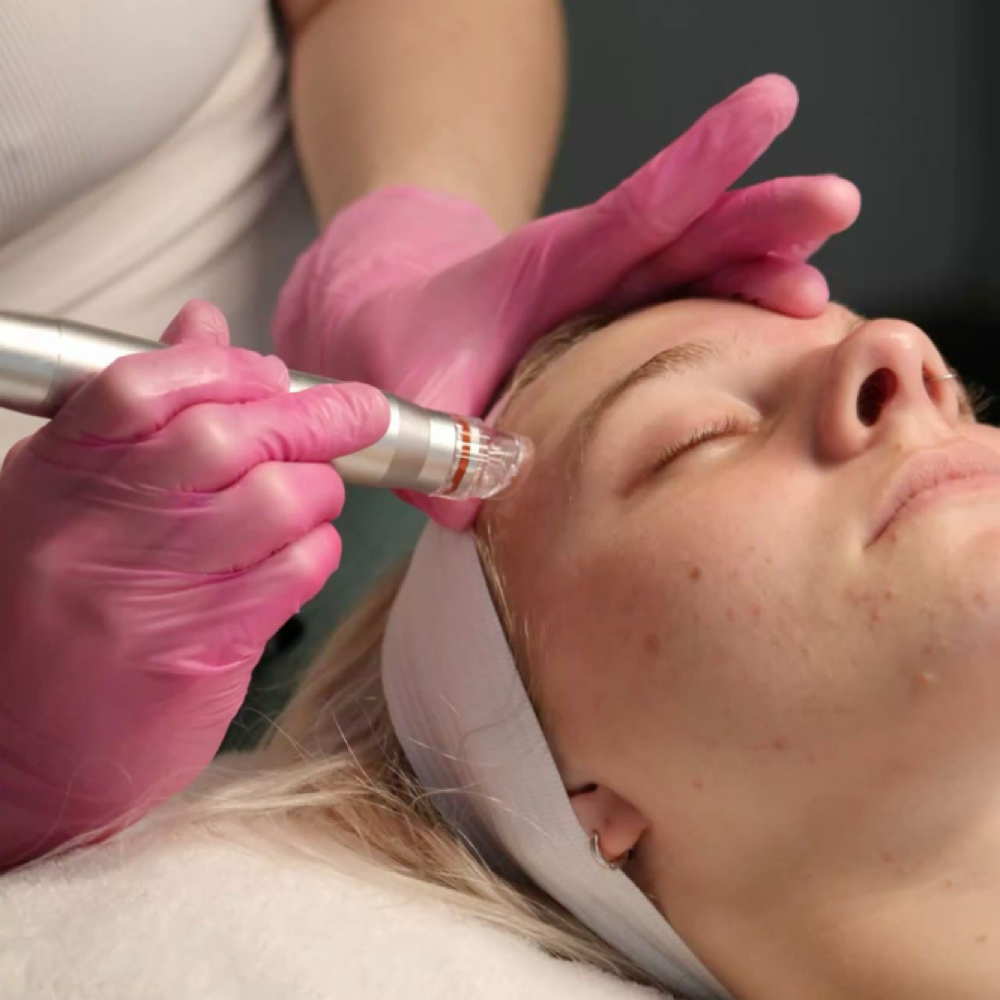Hydro Facial at Kayla Aesthetics in Longview, TX