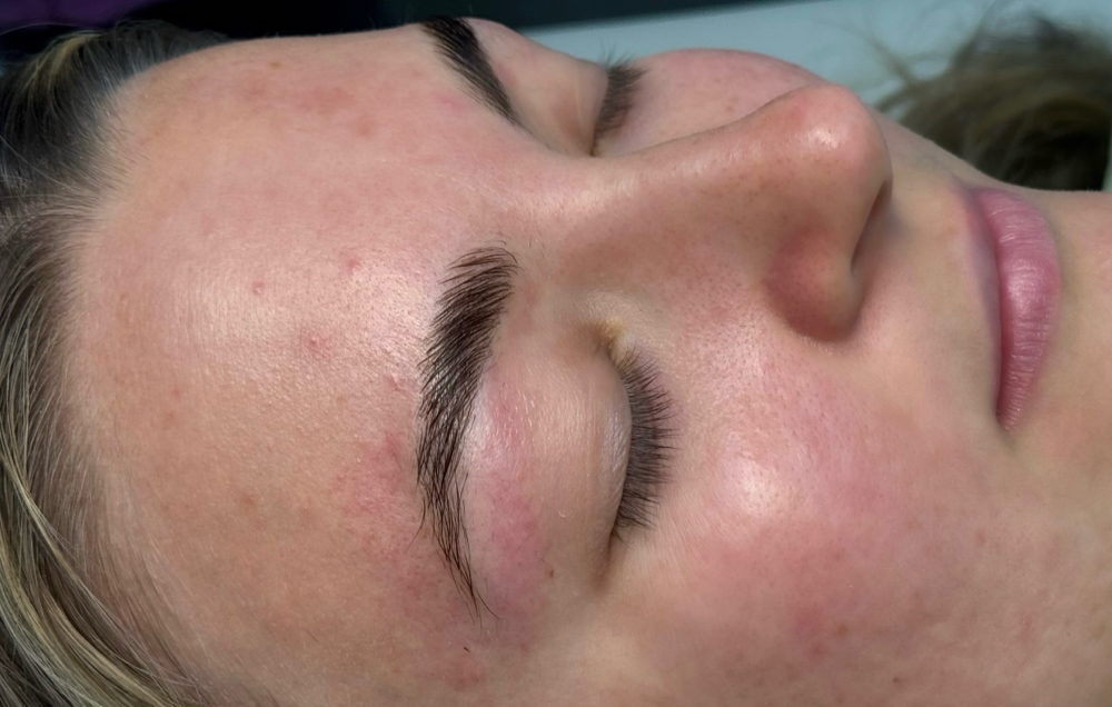 Brow Lamination