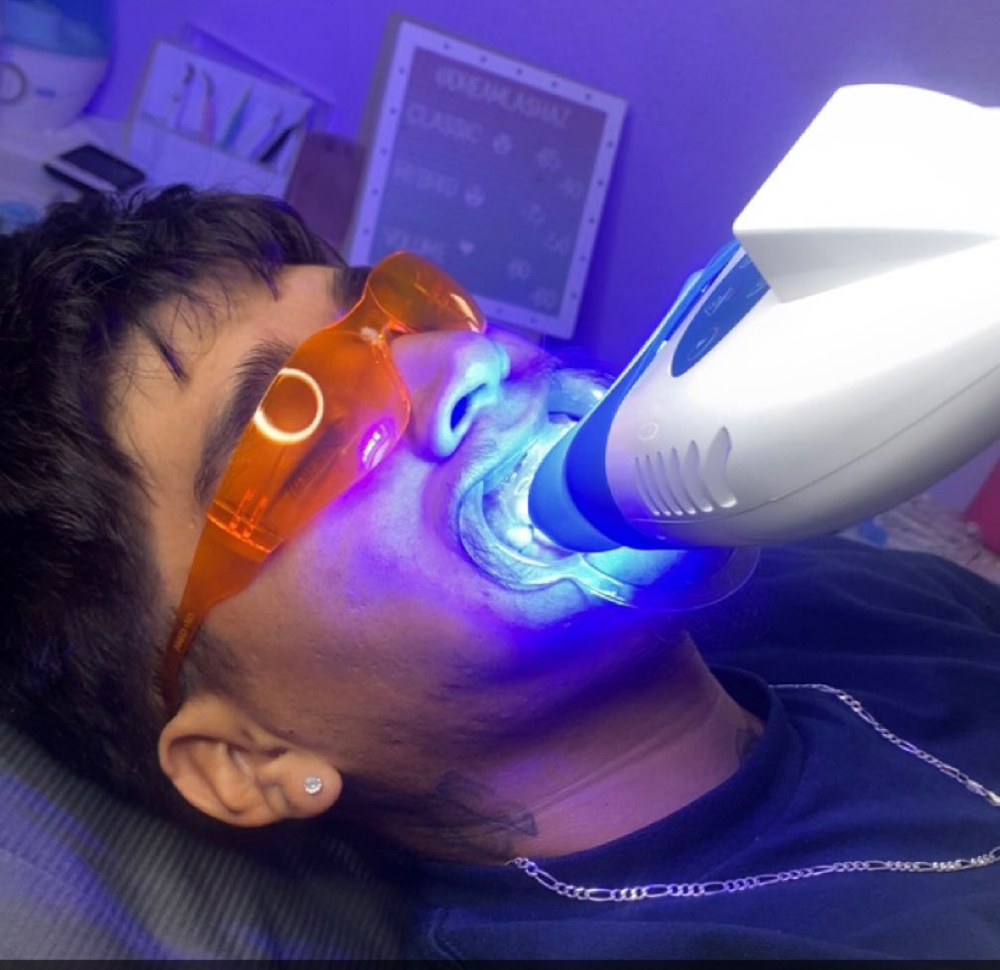 Teeth Whitening