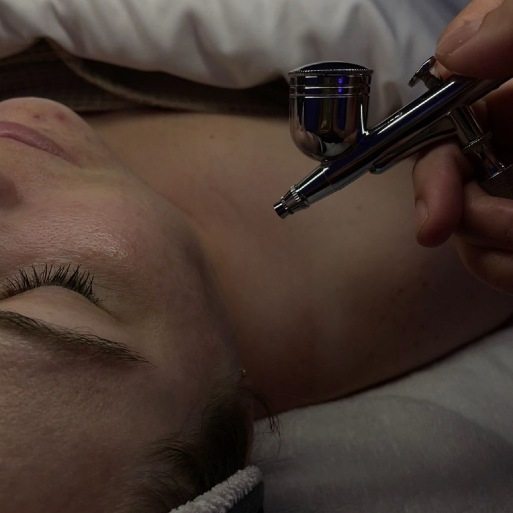 Acne Relief Oxygen Treatment at Moonstone Studio in Middletown, NY