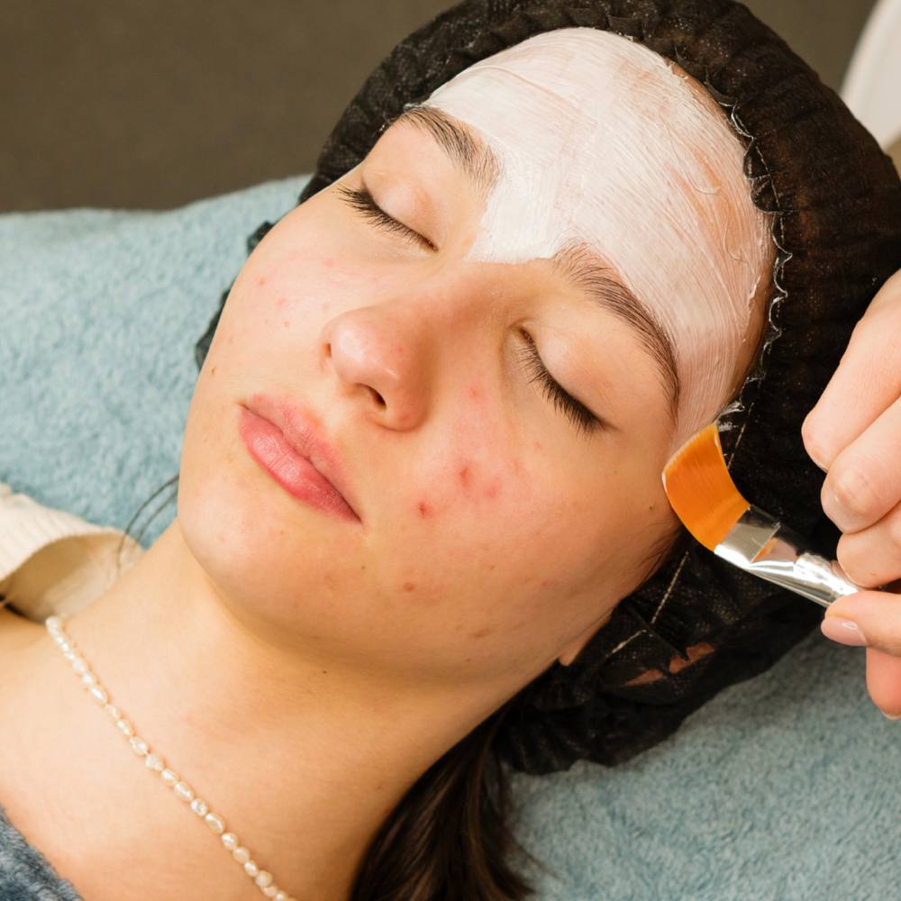 Acne Clarifying Facial