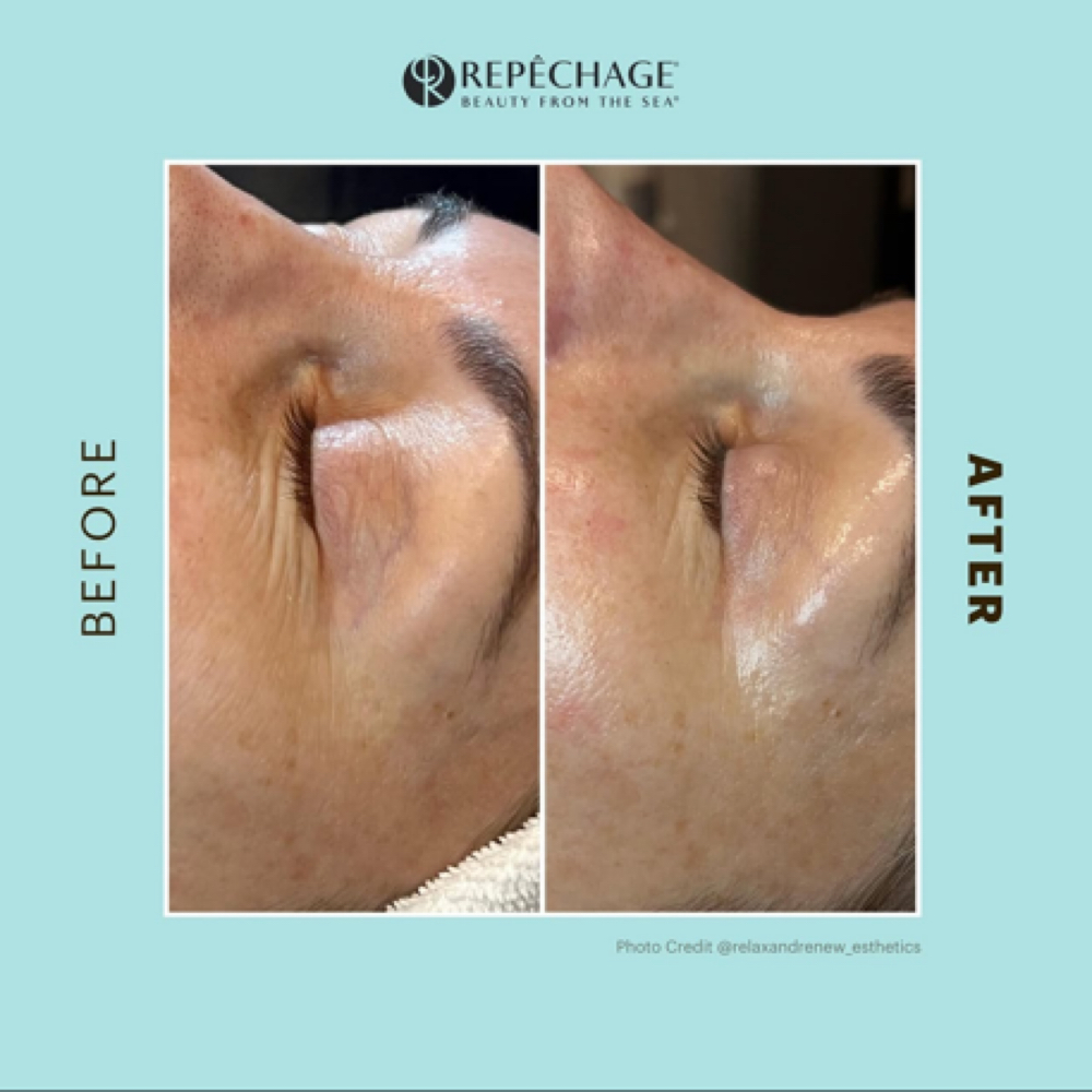 Opti Firm Eye Care Treatment 🪴 at Kiersten  Grisham in Peculiar, MO