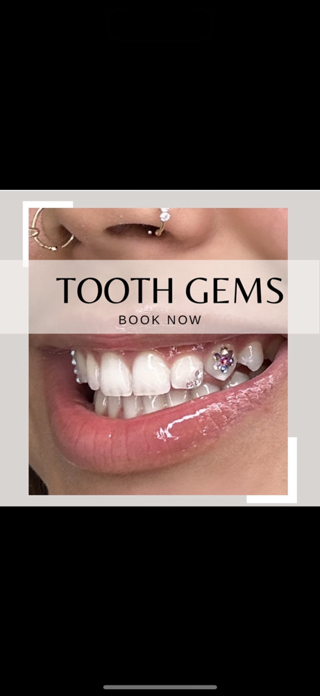 Tooth Gems