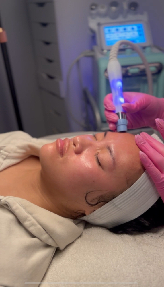 Deluxe Hydrofacial