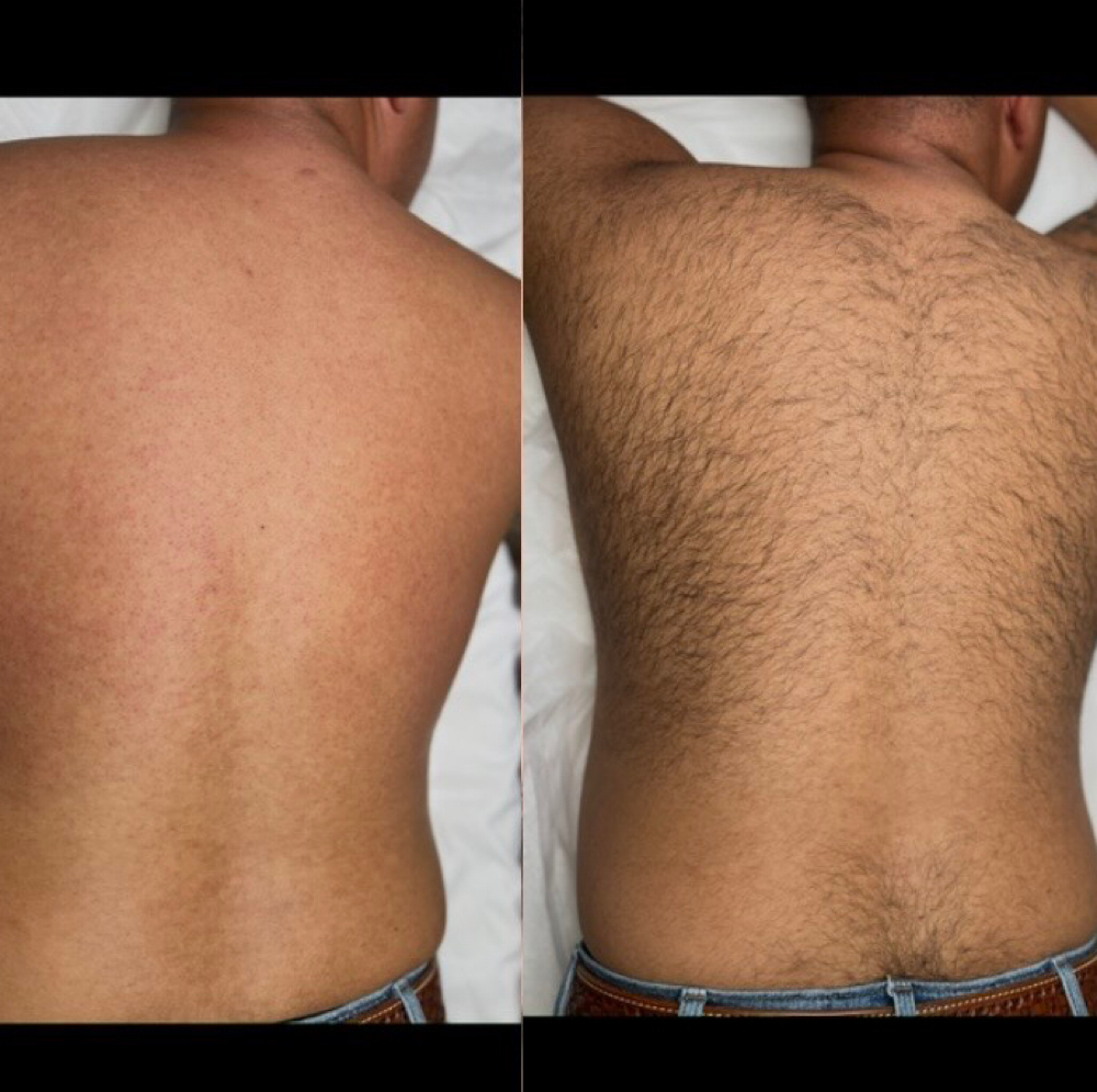 Full Back Wax at Beauty Ink Studio in Corpus Christi, TX