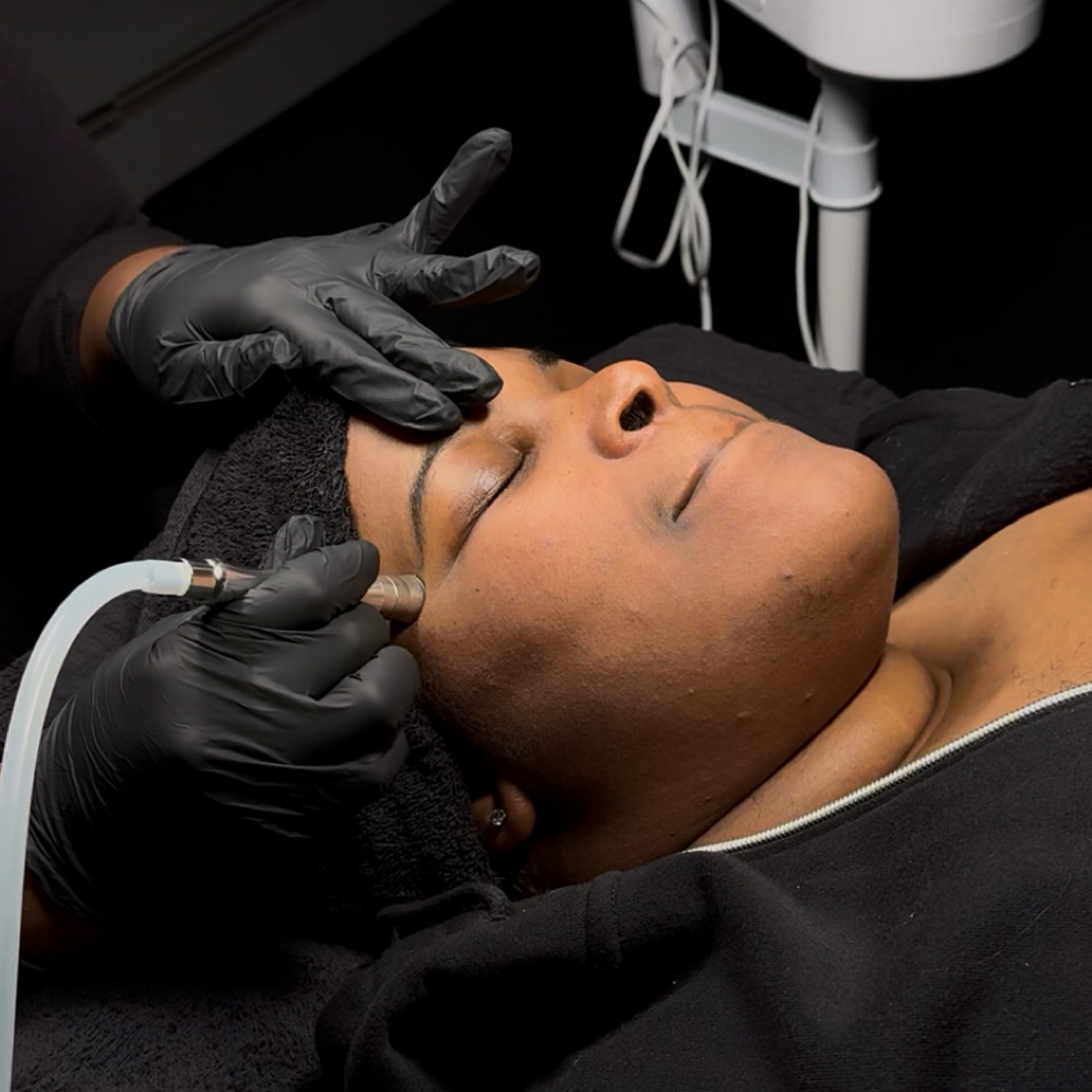 Microdermabrasion at Beauty Vault Studios in Hamden, CT
