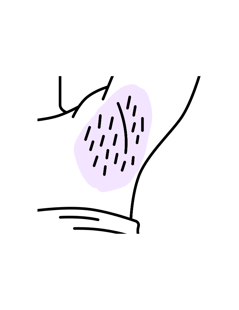 Underarms