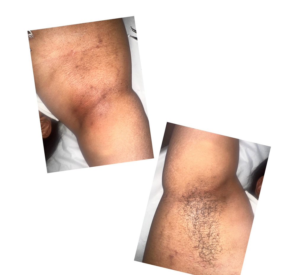 Under Arm Wax