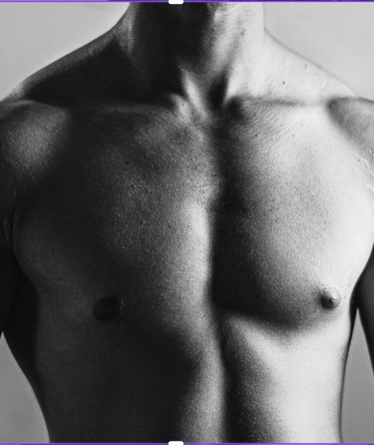 Laser Hair Removal - Men - Chest
