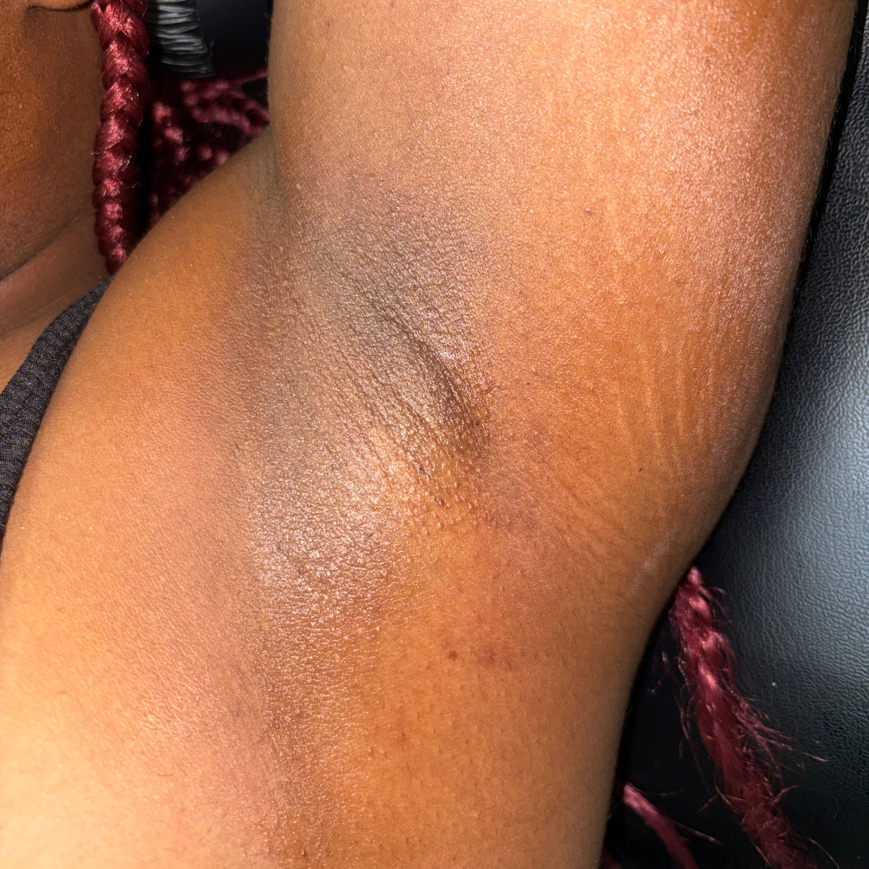 Underarms at Silky Smooth LLC in Fort Worth, TX