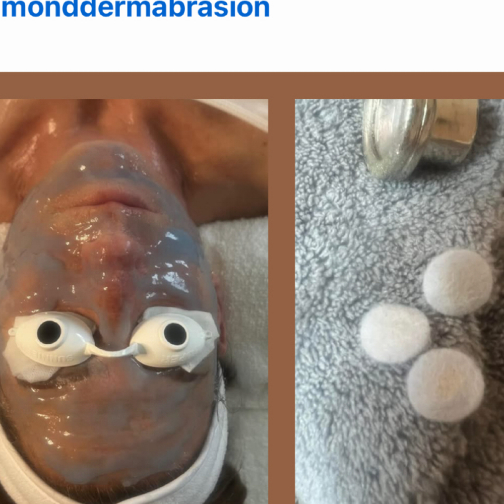 Facial Add On Diamond Dermabrasion at Michaela's Glow in Port Orange, FL